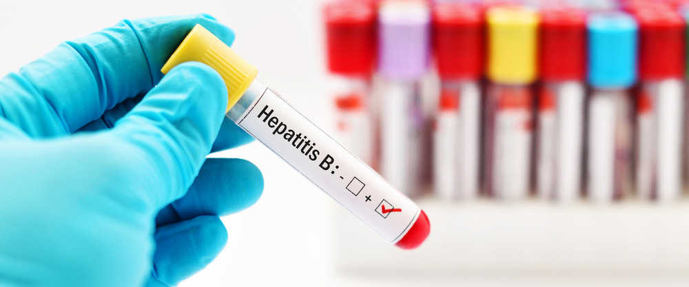 O que é hepatite B? Quais são os sintomas e métodos de tratamento?